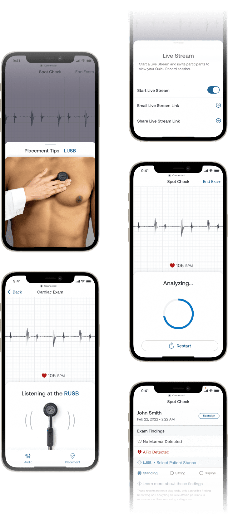 Digital Stethoscopes for Advanced Exams & Virtual Care Eko